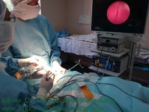 endoscope